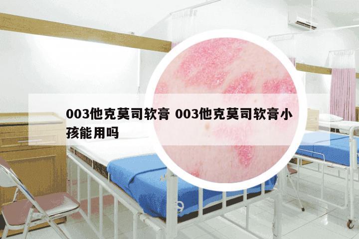 003他克莫司软膏 003他克莫司软膏小孩能用吗