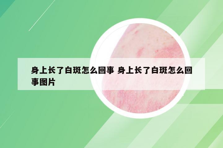 身上长了白斑怎么回事 身上长了白斑怎么回事图片