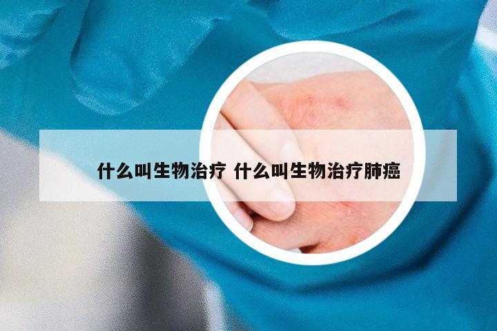 什么叫生物治疗 什么叫生物治疗肺癌