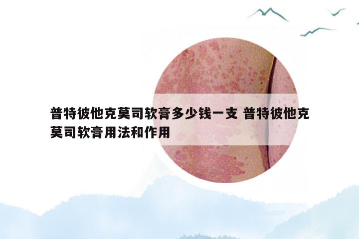 普特彼他克莫司软膏多少钱一支 普特彼他克莫司软膏用法和作用