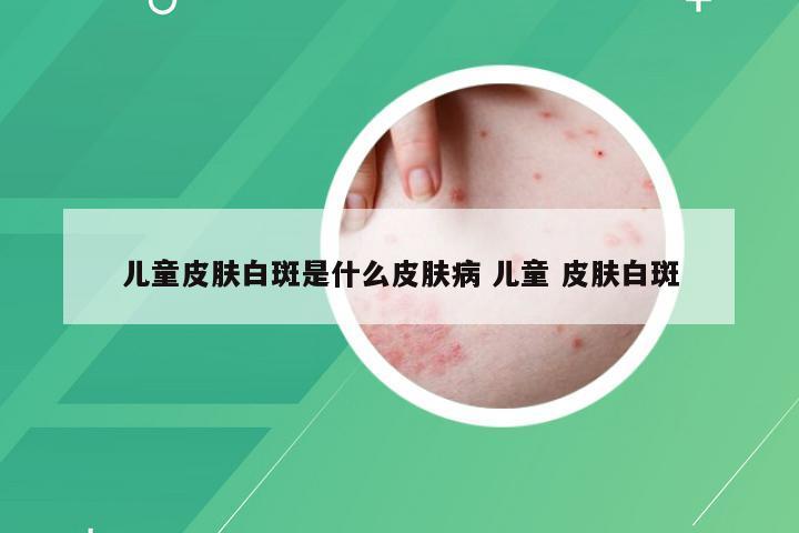 儿童皮肤白斑是什么皮肤病 儿童 皮肤白斑