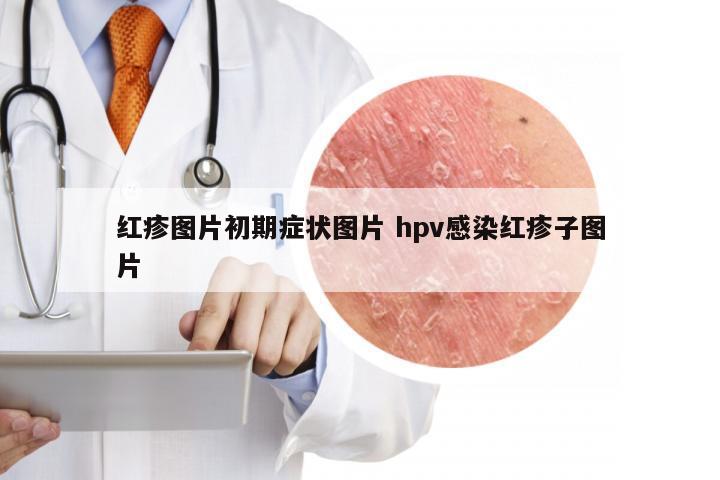 红疹图片初期症状图片 hpv感染红疹子图片