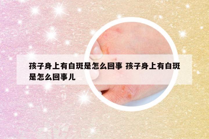 孩子身上有白斑是怎么回事 孩子身上有白斑是怎么回事儿