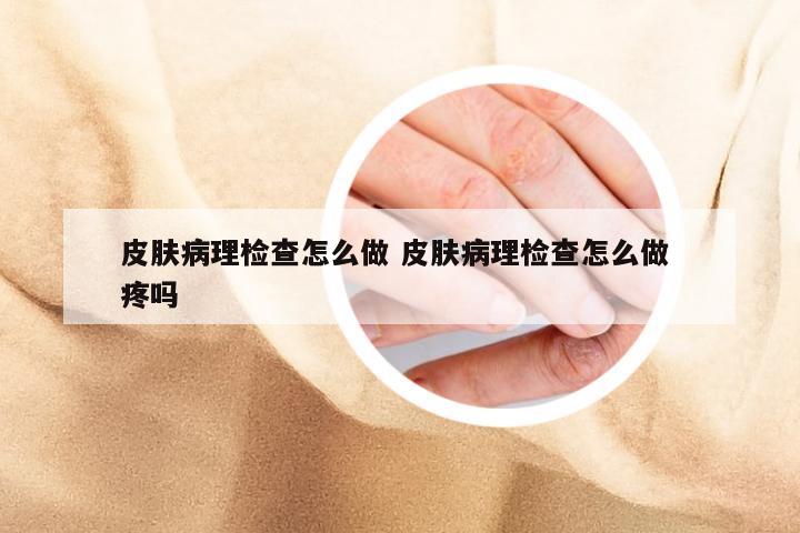 皮肤病理检查怎么做 皮肤病理检查怎么做 疼吗