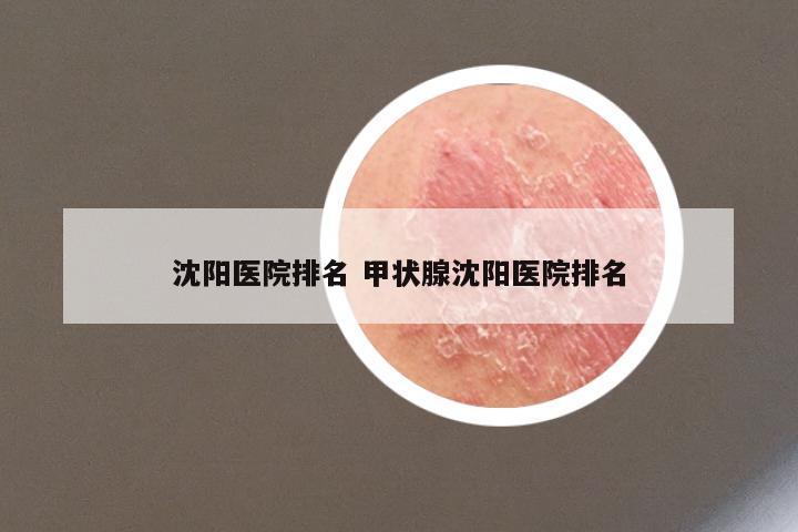 沈阳医院排名 甲状腺沈阳医院排名