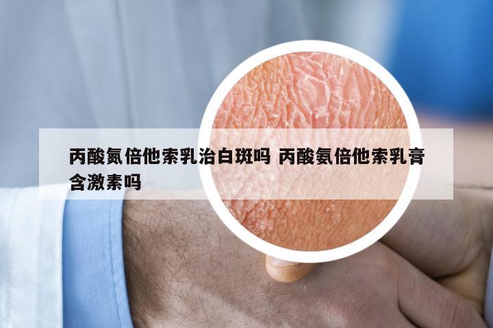 丙酸氮倍他索乳治白斑吗 丙酸氨倍他索乳膏含激素吗