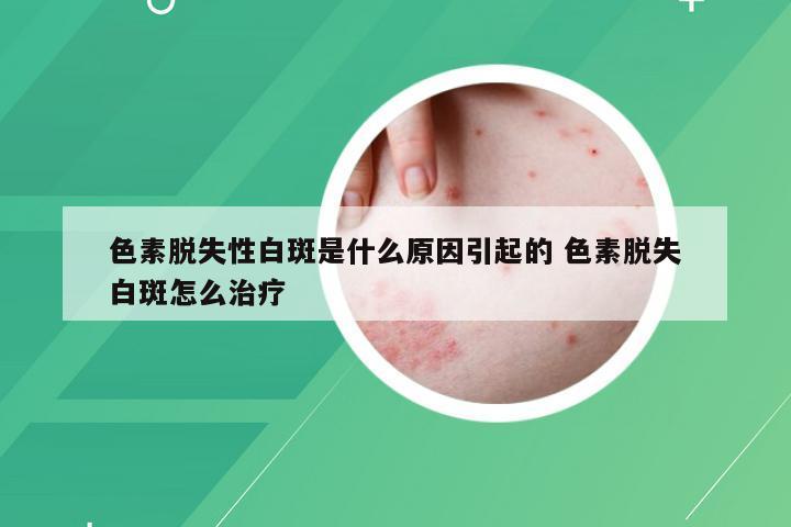 色素脱失性白斑是什么原因引起的 色素脱失白斑怎么治疗