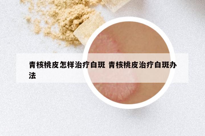 青核桃皮怎样治疗白斑 青核桃皮治疗白斑办法