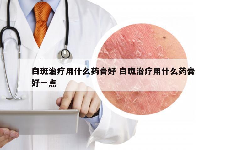 白斑治疗用什么药膏好 白斑治疗用什么药膏好一点