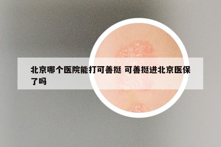 北京哪个医院能打可善挺 可善挺进北京医保了吗