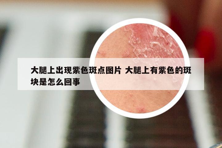 大腿上出现紫色斑点图片 大腿上有紫色的斑块是怎么回事