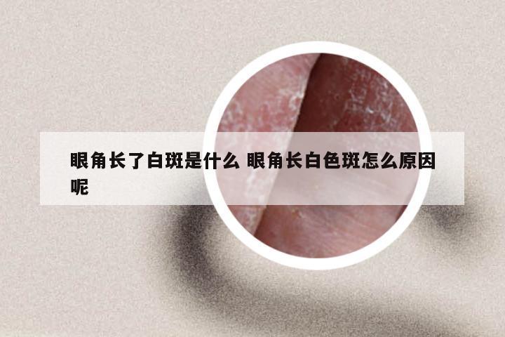 眼角长了白斑是什么 眼角长白色斑怎么原因呢