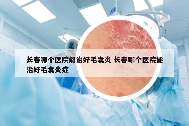 长春哪个医院能治好毛囊炎 长春哪个医院能治好毛囊炎症