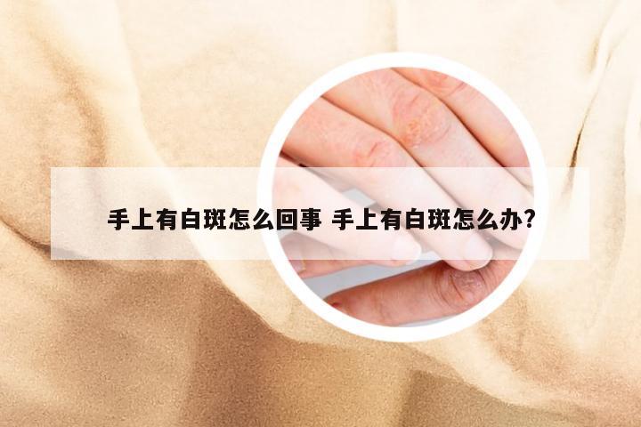 手上有白斑怎么回事 手上有白斑怎么办?