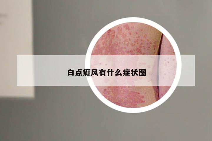 白点癫风有什么症状图