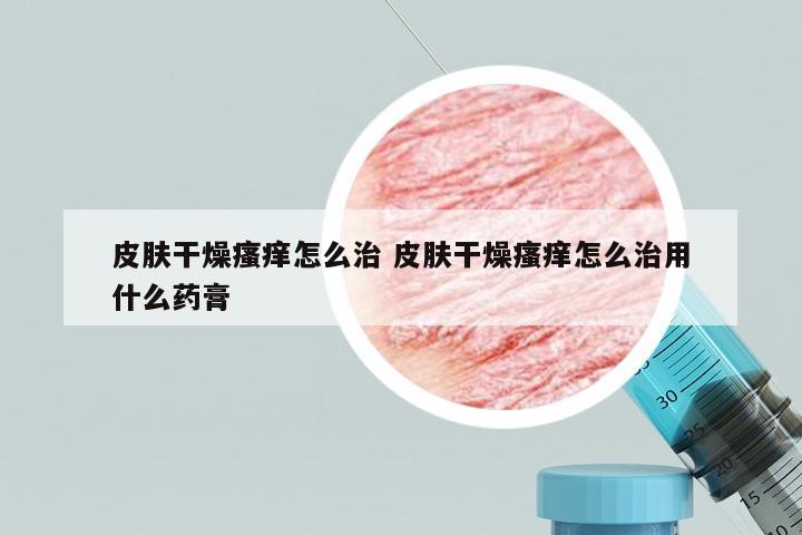 皮肤干燥瘙痒怎么治 皮肤干燥瘙痒怎么治用什么药膏