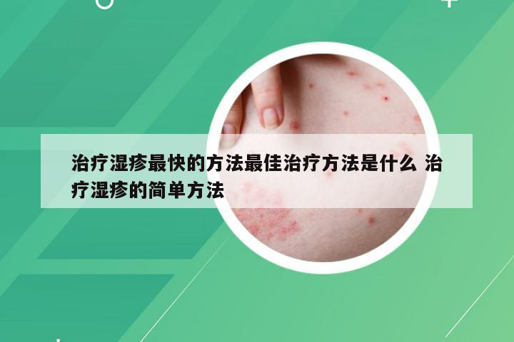 治疗湿疹最快的方法最佳治疗方法是什么 治疗湿疹的简单方法