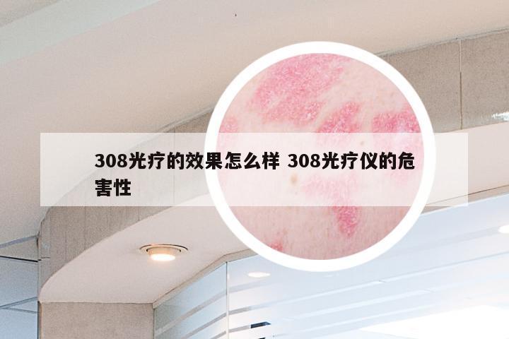 308光疗的效果怎么样 308光疗仪的危害性