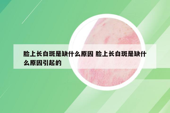 脸上长白斑是缺什么原因 脸上长白斑是缺什么原因引起的