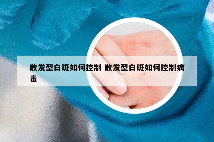 散发型白斑如何控制 散发型白斑如何控制病毒