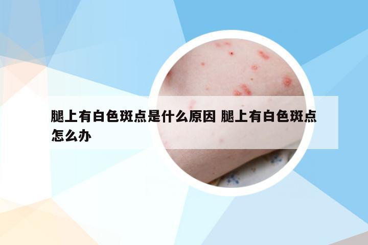 腿上有白色斑点是什么原因 腿上有白色斑点怎么办