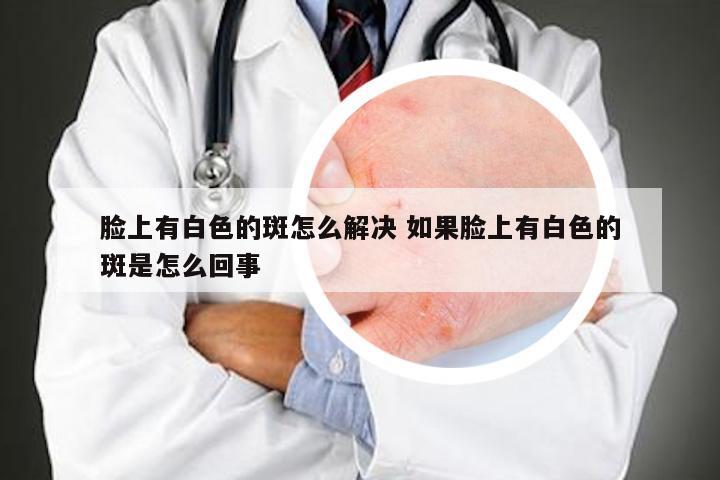 脸上有白色的斑怎么解决 如果脸上有白色的斑是怎么回事