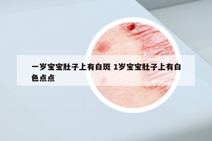 一岁宝宝肚子上有白斑 1岁宝宝肚子上有白色点点