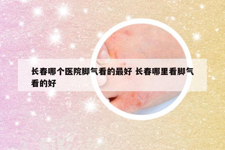 长春哪个医院脚气看的最好 长春哪里看脚气看的好