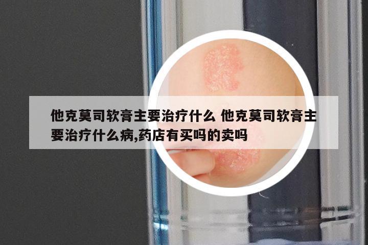 他克莫司软膏主要治疗什么 他克莫司软膏主要治疗什么病,药店有买吗的卖吗