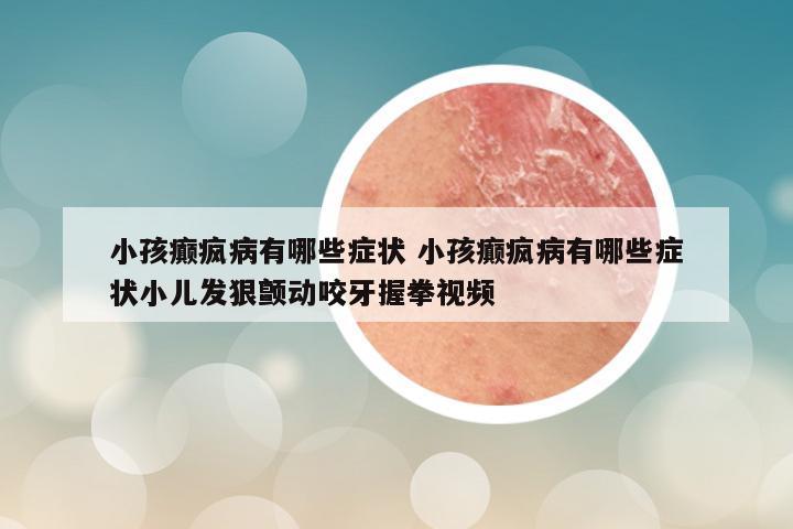 小孩癫疯病有哪些症状 小孩癫疯病有哪些症状小儿发狠颤动咬牙握拳视频