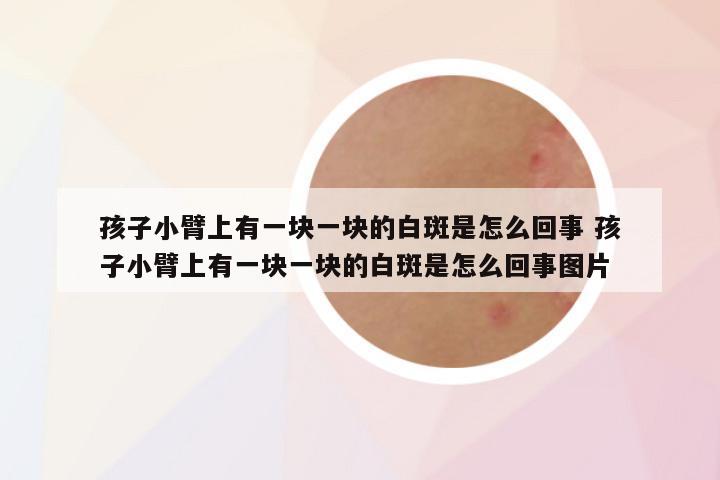 孩子小臂上有一块一块的白斑是怎么回事 孩子小臂上有一块一块的白斑是怎么回事图片