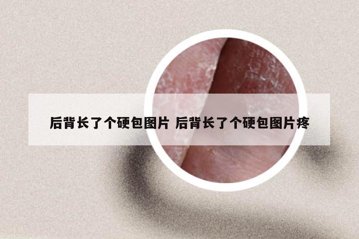 后背长了个硬包图片 后背长了个硬包图片疼