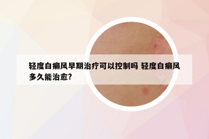 轻度白癞风早期治疗可以控制吗 轻度白癞风多久能治愈?