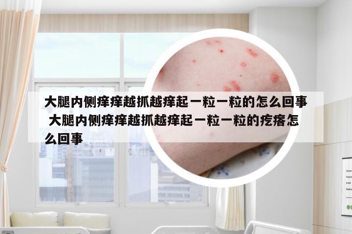 大腿内侧痒痒越抓越痒起一粒一粒的怎么回事 大腿内侧痒痒越抓越痒起一粒一粒的疙瘩怎么回事