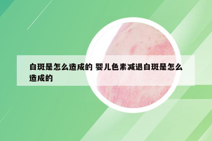 白斑是怎么造成的 婴儿色素减退白斑是怎么造成的