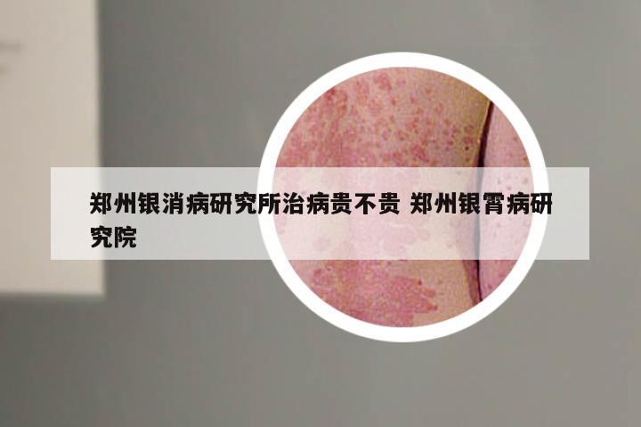 郑州银消病研究所治病贵不贵 郑州银霄病研究院