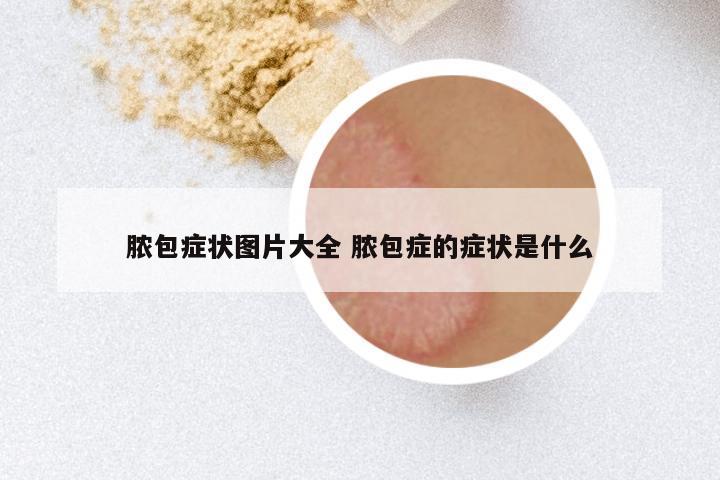 脓包症状图片大全 脓包症的症状是什么