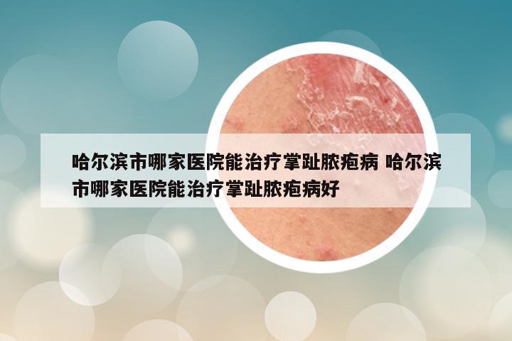 哈尔滨市哪家医院能治疗掌趾脓疱病 哈尔滨市哪家医院能治疗掌趾脓疱病好