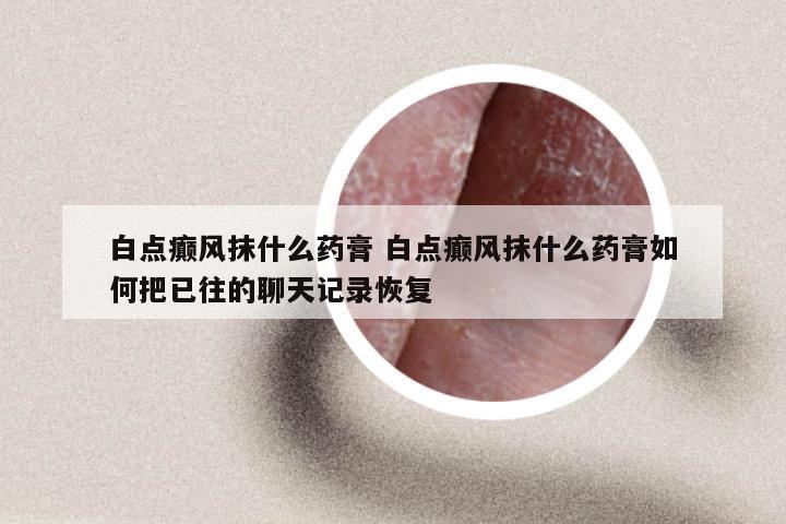 白点癫风抹什么药膏 白点癫风抹什么药膏如何把已往的聊天记录恢复