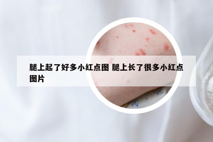 腿上起了好多小红点图 腿上长了很多小红点图片