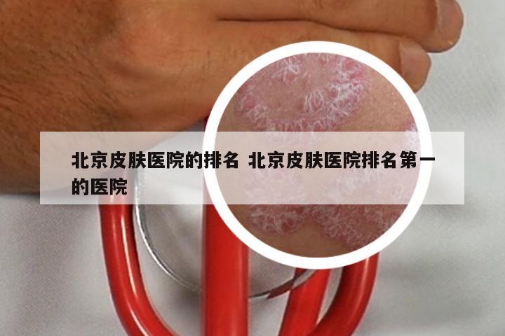 北京皮肤医院的排名 北京皮肤医院排名第一的医院