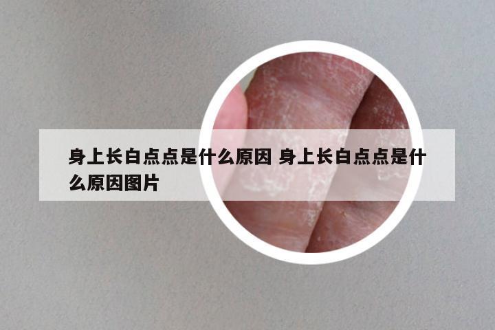 身上长白点点是什么原因 身上长白点点是什么原因图片