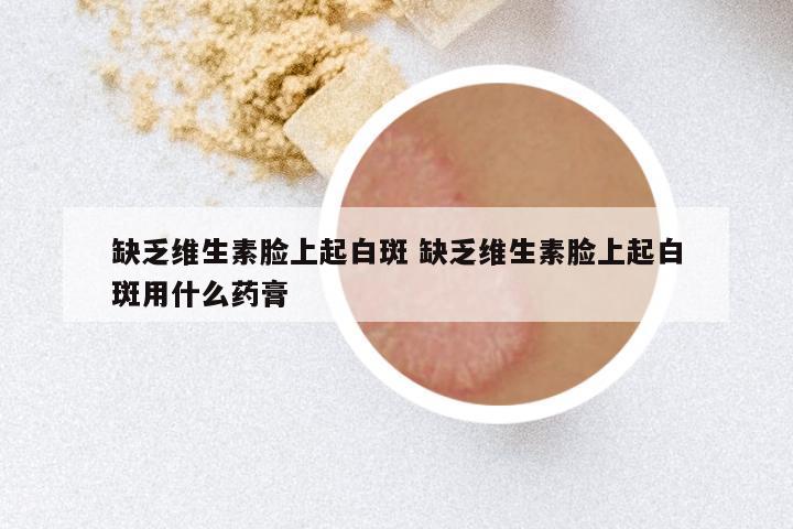 缺乏维生素脸上起白斑 缺乏维生素脸上起白斑用什么药膏