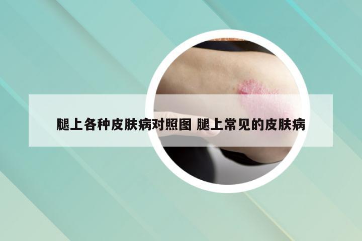 腿上各种皮肤病对照图 腿上常见的皮肤病