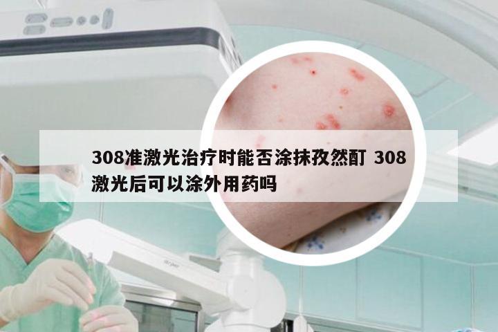 308准激光治疗时能否涂抹孜然酊 308激光后可以涂外用药吗