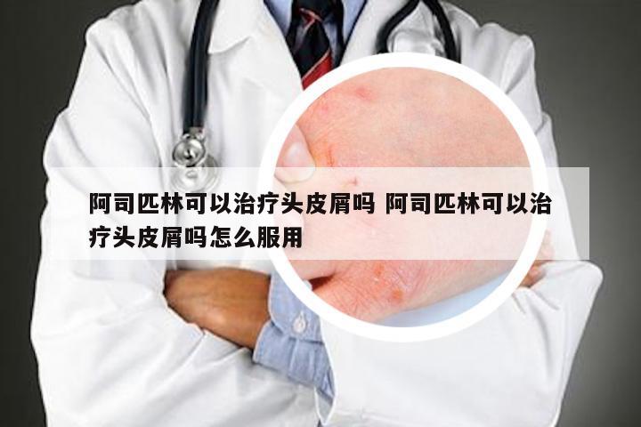 阿司匹林可以治疗头皮屑吗 阿司匹林可以治疗头皮屑吗怎么服用