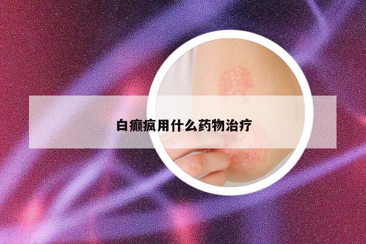 白癫疯用什么药物治疗