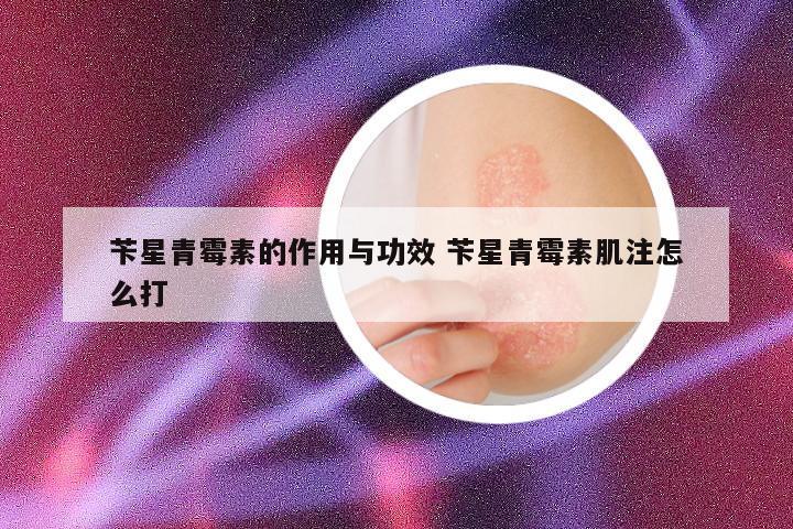 苄星青霉素的作用与功效 苄星青霉素肌注怎么打