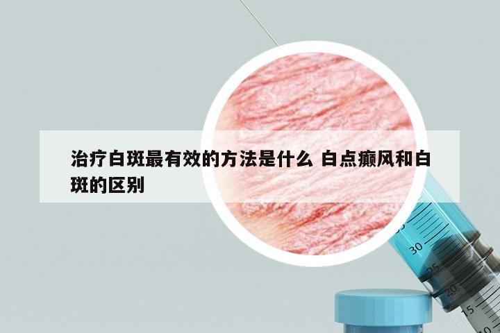 治疗白斑最有效的方法是什么 白点癫风和白斑的区别