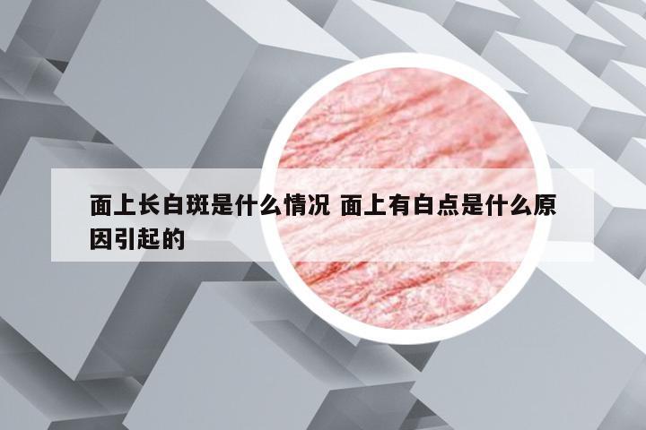 面上长白斑是什么情况 面上有白点是什么原因引起的